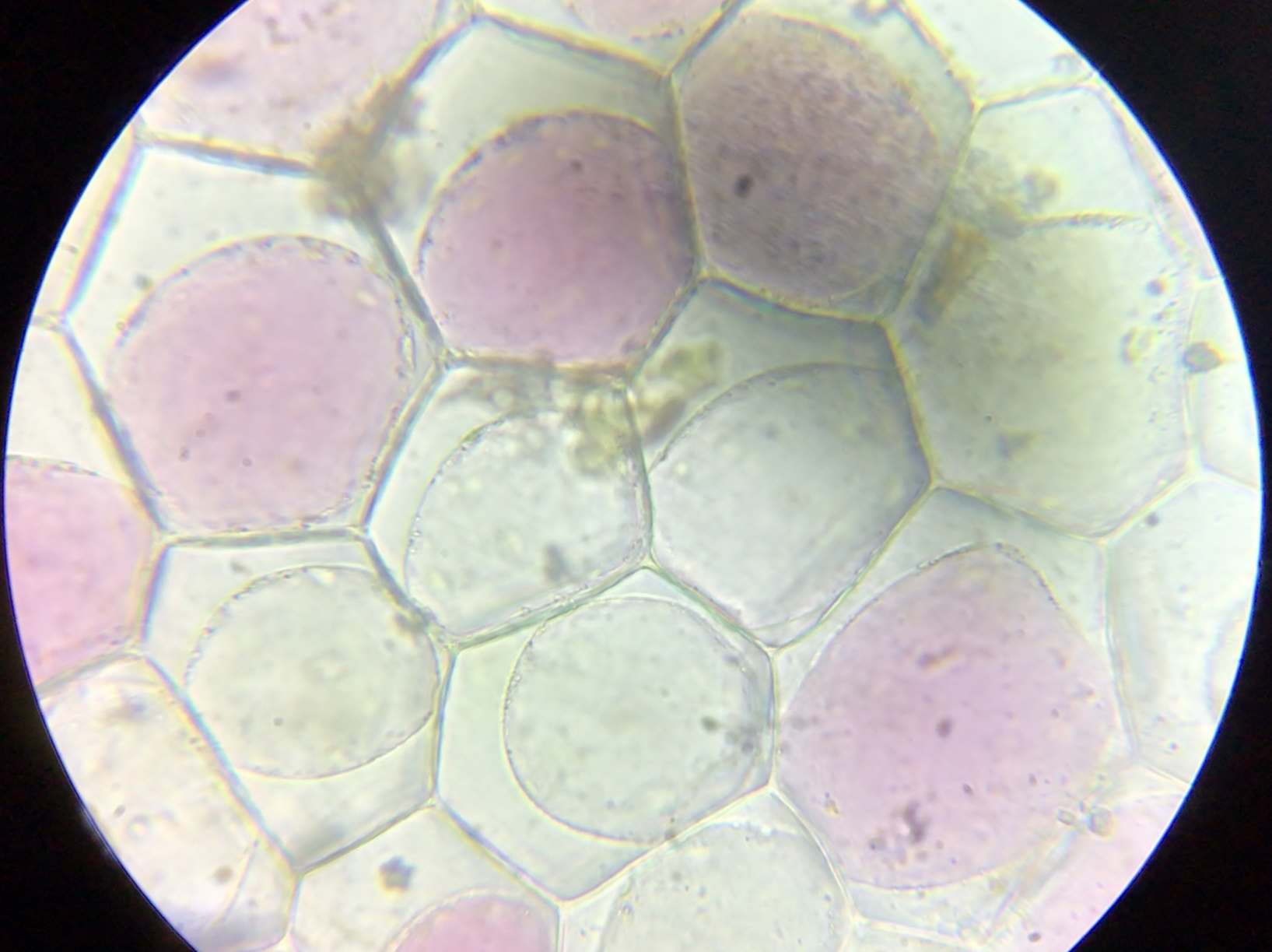 学3年 理科S 「ユキノシタの原形質分離」~これがアントシア~ン~ 尚学館中学校・高等部